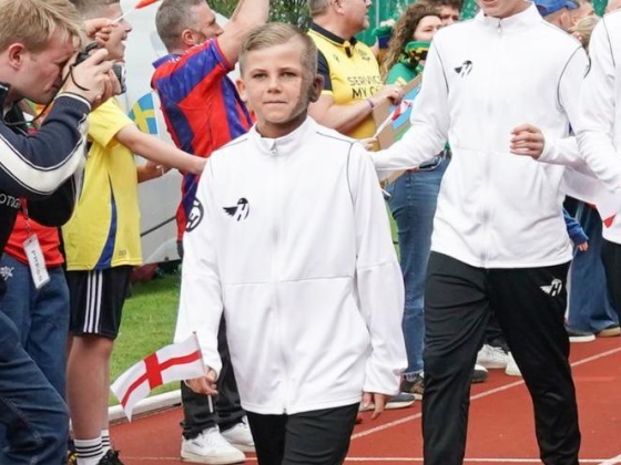 Az anyajegy nem akadály a fiatal futball-tévésztár számára