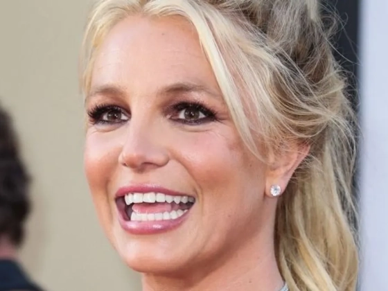Kitálalt Britney Spears: tönkretette az arcát a botox