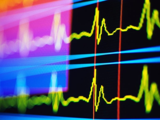 Két másodperc alatt kiszúrja a szívbetegségeket egy új mesterséges intelligencia