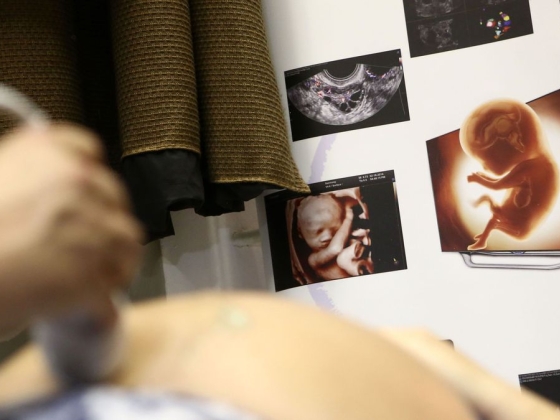 Óriási a felháborodás a Szent Imre Kórház döntése miatt, októbertől él a változás a szülészeten